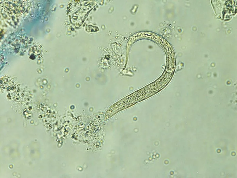 hookworm
