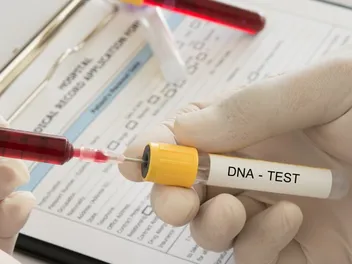 Can You Register a Dog With a DNA Test? Surprising Facts