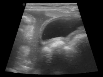 Fluid In Dog's Abdomen: Causes, Signs & Treatment (Vet Answer)