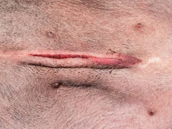 How Big Is a Spay Incision? Vet-Reviewed Health Facts