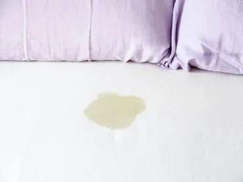What It Actually Means When a Dog Leaks Urine While They Sleep (It’s Serious)