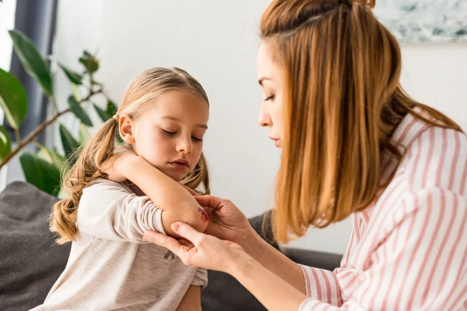 mother-caring-injured-daughter-at-home