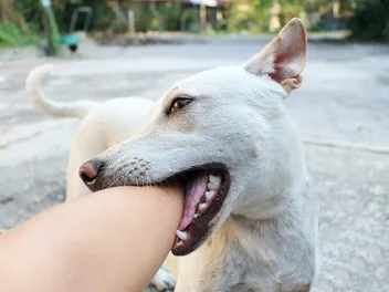 What & When Is Dog Bite Prevention Week? (2026 Update)