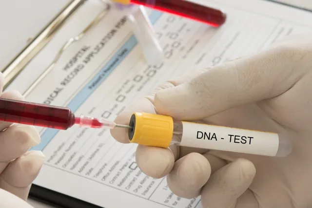 Can You Register a Dog With a DNA Test? Surprising Facts