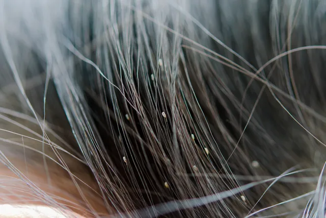 Can Dogs Get Lice From Humans? Vet-Approved Facts & FAQ