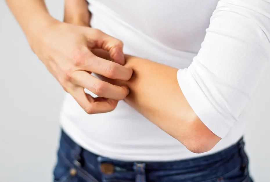 Woman scratching her arm