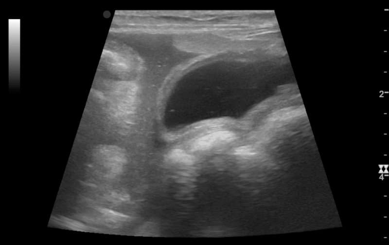 Fluid In Dog's Abdomen: Causes, Signs & Treatment (Vet Answer)
