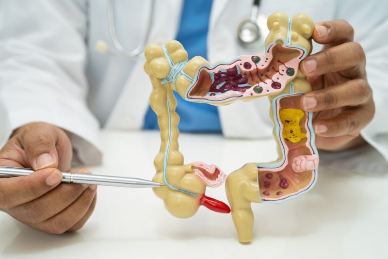 doctor holding anatomy model